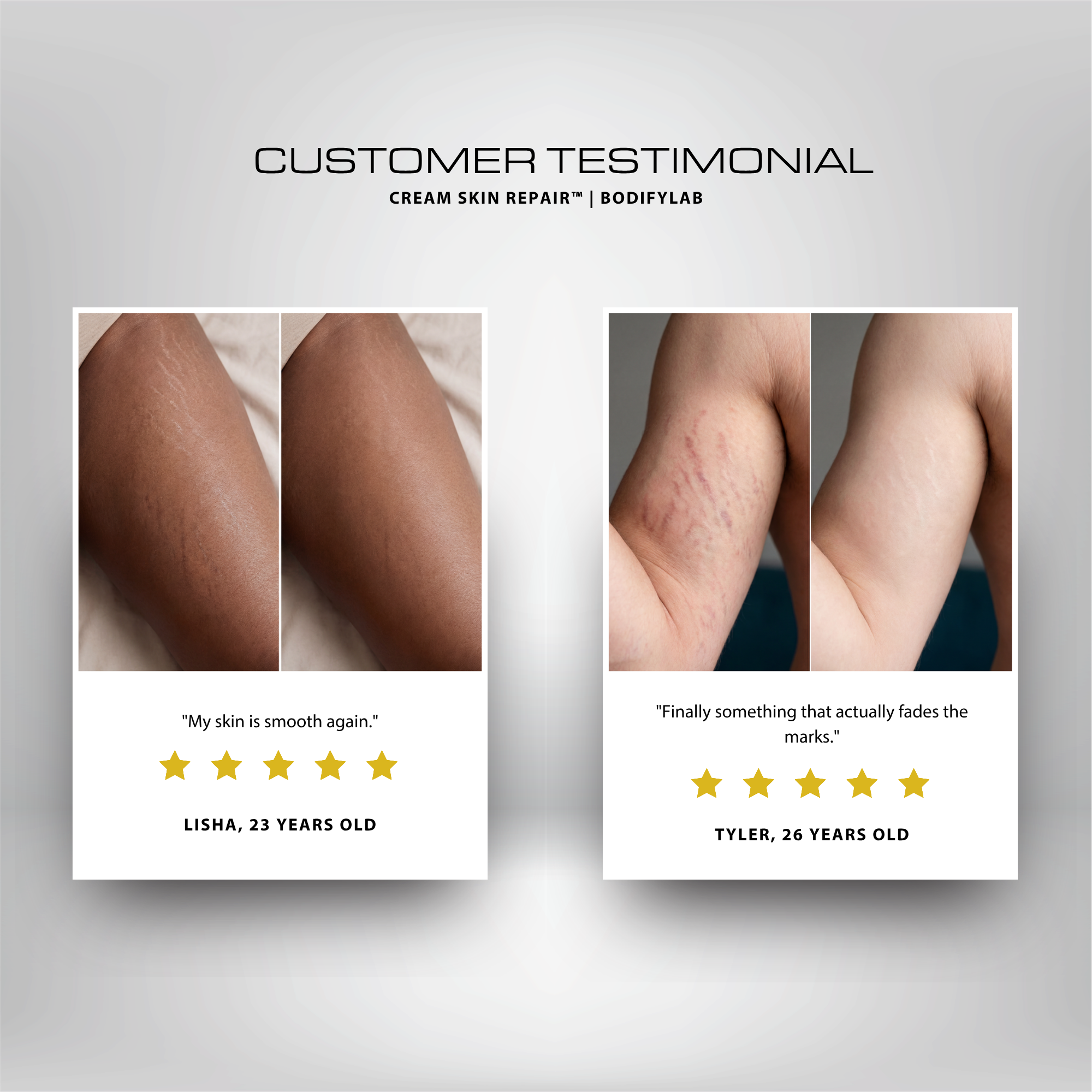 Anti-vergetures | SKIN REPAIR™